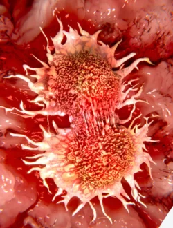 cancer eucaim cancer eucaim