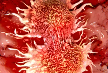 cancer eucaim cancer eucaim